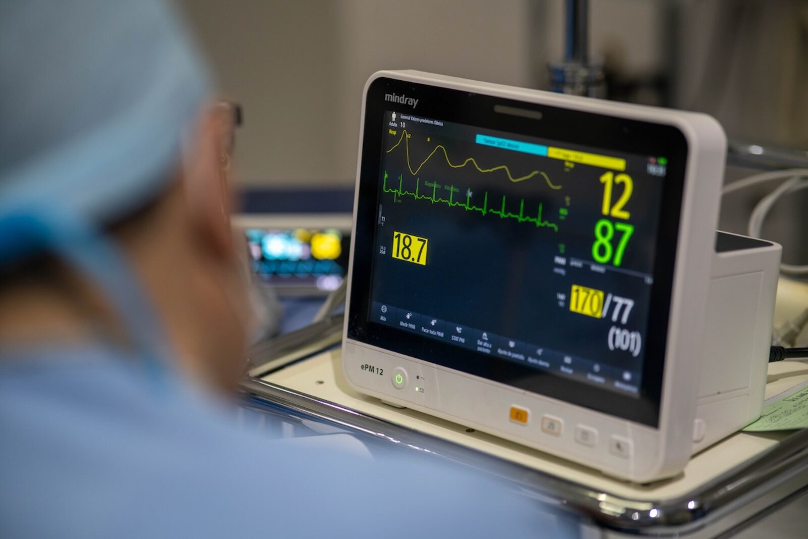 Monitoreo continuo de signos vitales durante la cirugía